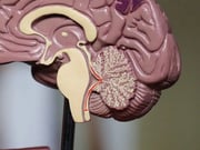 Stroke Awareness