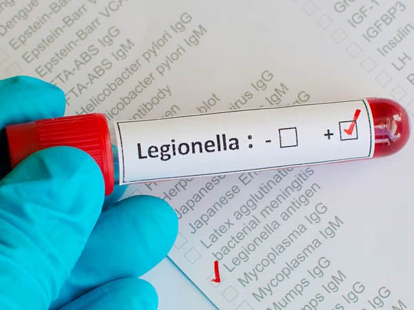 Legionella Risk Assessments