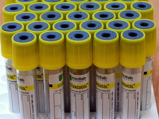 Industrial Lab Labels Supplier
