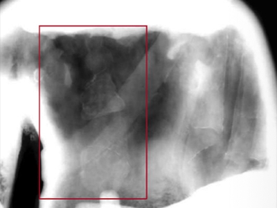 X-Ray Copying