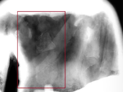 X-Ray Copying