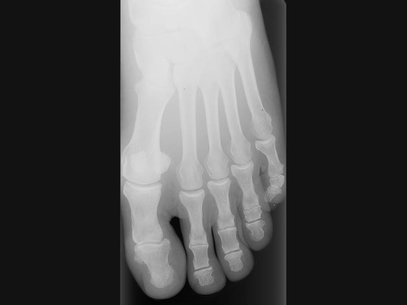 Medical X-Ray Digitisation
